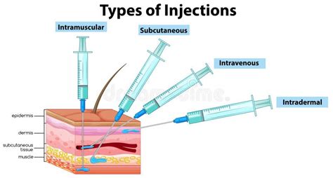 Types D Injections Sur Le Fond Blanc Illustration De Vecteur