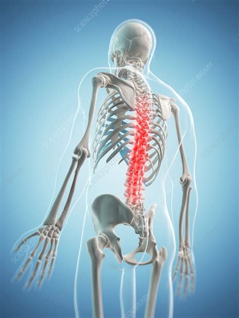 Back Pain Conceptual Artwork Stock Image F0063198 Science Photo