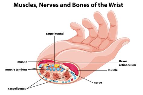 Carpal Tunnel Syndrome Complete Physio