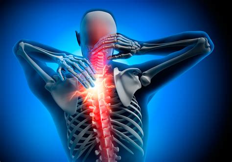 Poor posture with a forward bend can weaken your upper back muscles and create a hump at the base of your neck. FREE Dinner Seminar on Back/Neck Pain! | NWA Health ...