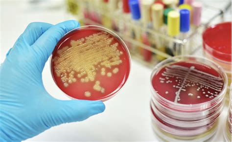 Científicos Del Csic Descubren Una Terapia Contra Las Bacterias Resistentes A Antibióticos