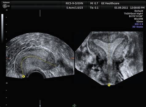 Principles Of 3d Ultrasound Radiology Key