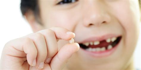 Baby Teeth Fall Out Age Complications And More Onlymyhealth