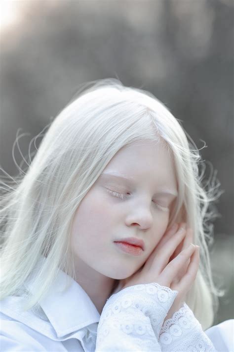 Modelo Albino Albino Model Pretty People Beautiful People Ethereal