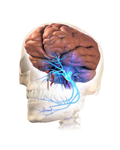 Trigeminal Neuralgia Causes Symptoms And Treatments