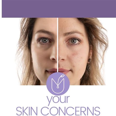 Best Skin Treatments For Your Skin Concerns Christchurch Nz
