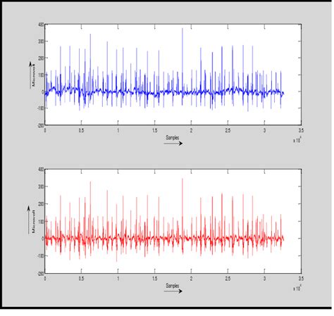 Original Emg Signal And Filtered Blf Download Scientific Diagram