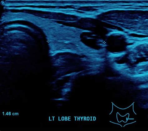 Foot Ultrasound Diagnostic Imaging Melbourne Radiology