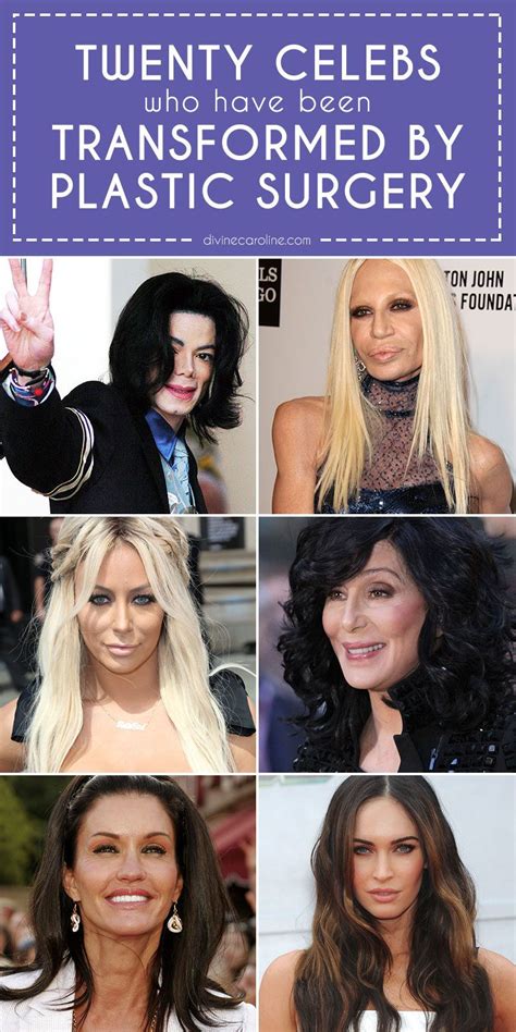 15 Celebrities Who Have Been Transformed By Plastic Surgery More