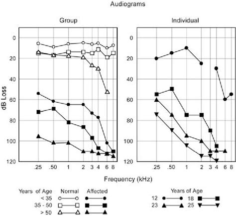 Left Panel Averaged Pure Tone Audiogram As A Function Of Age