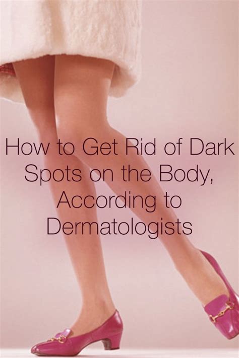 How To Get Rid Of Dark Spots On The Body According To Dermatologists
