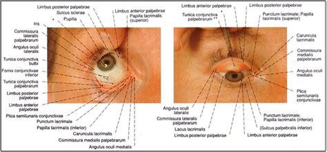 Ketumbit adalah keradangan kelenjar pada kelopak mata atau pada akar bulu mata. Blog Jefri Kurniawan: Anatomi Mata