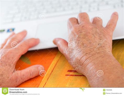 Age Spotted Hands On The Laptop Stock Photo Image Of Connection