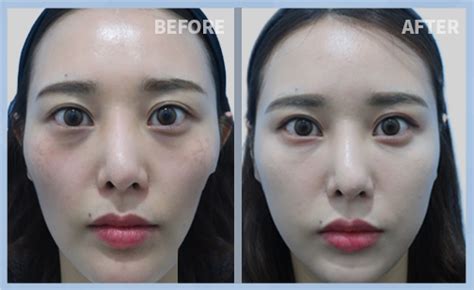 Me Clinic Seoul Skin Care Laser Hair Removal Obesity Care And
