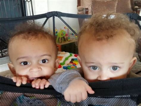 Identical Twin Boys Were Born With Completely Different Skin Tones