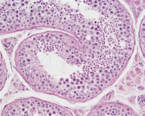 Filetestis Histology 009 Embryology