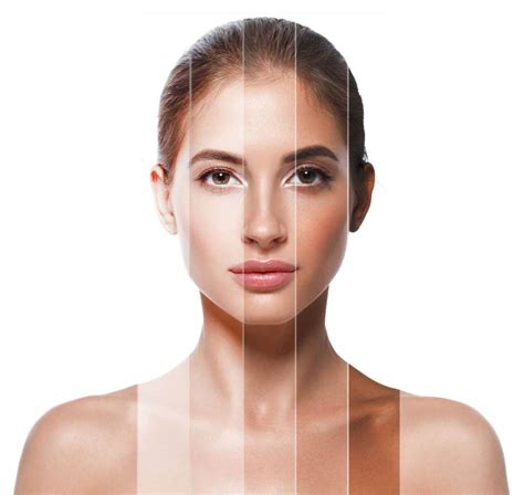 What Are The Causes Of Skin Hyperpigmentation Health N