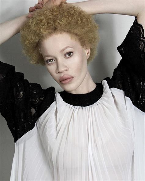 Meet Diandra Forrest Stunning Albino African American Model Design You Trust