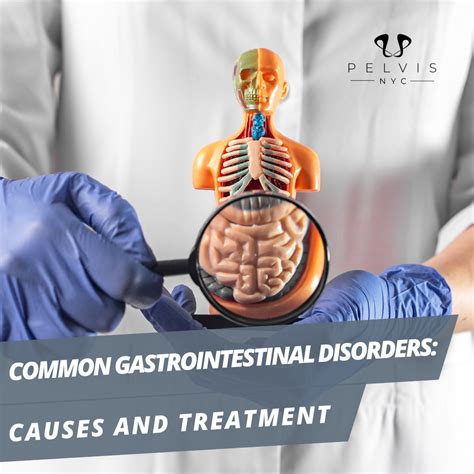 Common Gastrointestinal Disorders Causes And Treatment Pelvisnyc