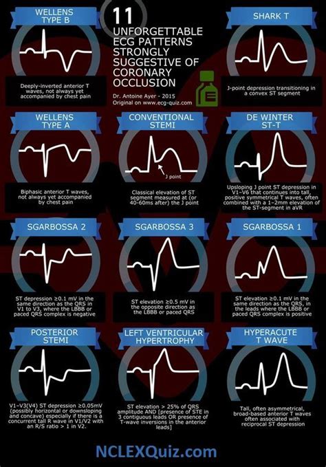 Ekg Infographics Critical Care Nursing Nurse Emergency Medicine