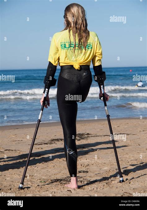 Woman Lost Leg Hi Res Stock Photography And Images Alamy
