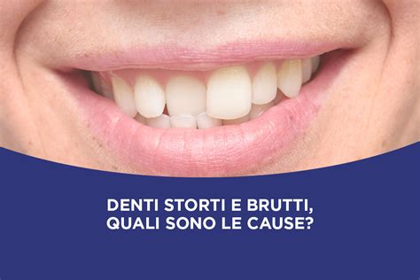 Le Cause E I Rimedi Contro I Denti Storti Studio Dentistico Macaluso