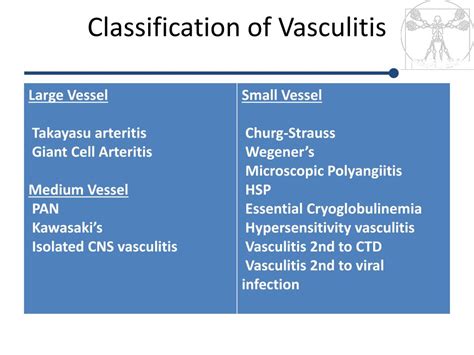 Vasculitis Types