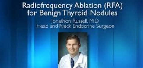 Radiofrequency Ablation Rfa For Benign Thyroid Nodules Boltz Research