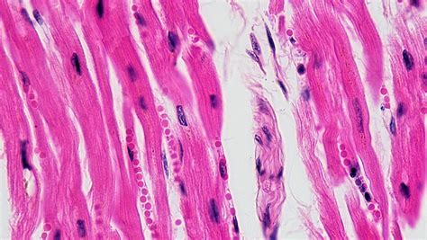 A muscle cell is a long cell compared to other forms of cells, and many muscle cells connect together to form the long fibers found in muscle tissue. Muscle Tissue Under Microscope - Micropedia
