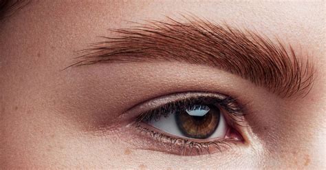 How To Tell If You Have Eyebrow Dandruff And How To Get Rid Of It