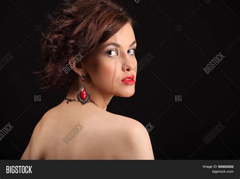 Beautiful Girl Scar On Image And Photo Free Trial Bigstock