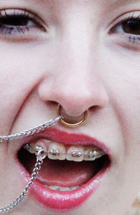 Fy Billie Turnbull Braces Girls Braces Piercing