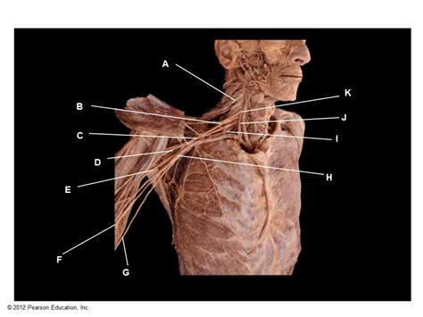 Brachial Plexus Cadaver Diagram Quizlet