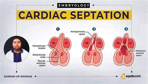 Cardiac Septation Online Medical Embryology Lecture