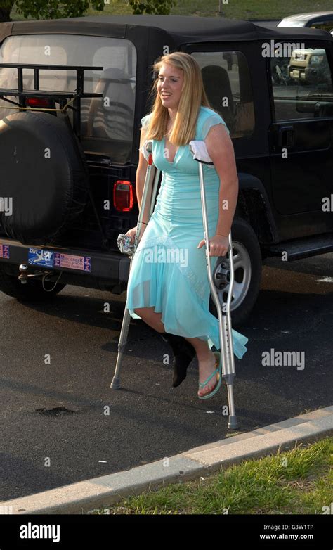 Teenage Girl On Crutches Stock Photo Alamy