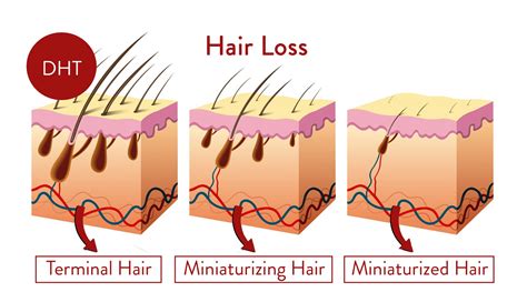 Hair Loss Factors