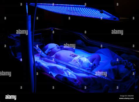 Newborn Baby With Neonatal Jaundice And High Bilirubin