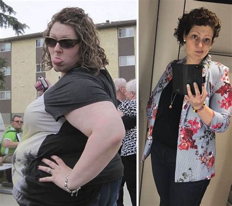 This Woman Lost 150 Pounds After Her Nutritionist Advised Her To Follow 3 Simple Rules