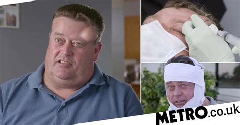 Man Has Giant Cyst Removed From His Head On Dr Pimple Popper Metro News