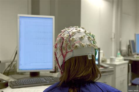 立体定向脑电图电极植入——定向制导治癫痫