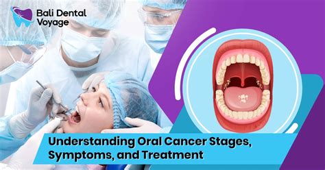 Oral Cancer Symptoms Treatment And Stages
