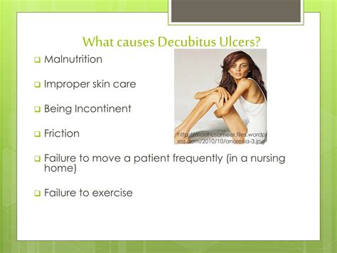 Ppt The Truth About Decubitus Ulcers Powerpoint Presentation Free Download Id3015233