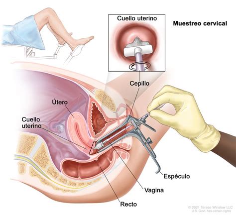 Mapa Mental Citologia Lea Ler E Aprender Images Porn Sex Picture