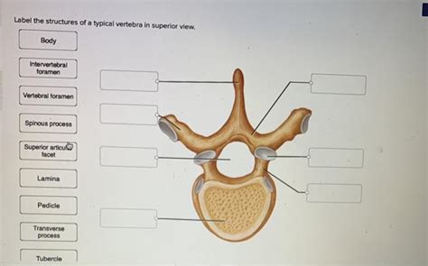 Solved Label The Structures Of A Typical Vertebra In Chegg Com