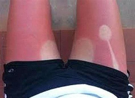 Of The Worst Tanning Fails You Ll See This Summer The Dreaded