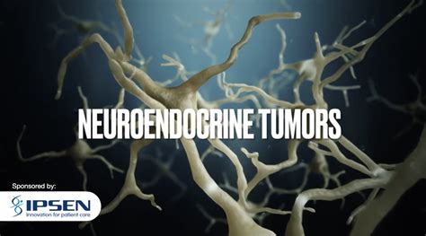 Neuroendocrine Tumors Disease Basics Rare Disease Hub