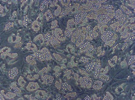 Mesenchymal Stem Cell Adipogenic Differentiation Medium 2 Promocell