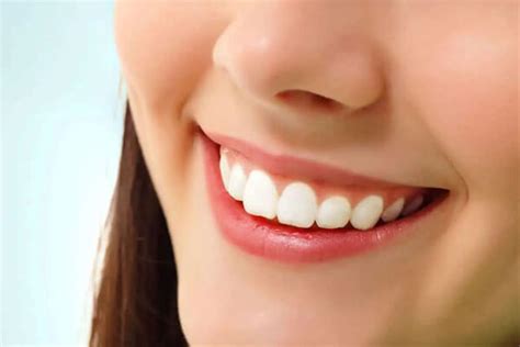Dentures Vs Veneers Which Is The Best Option