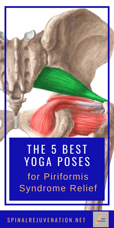 The 5 Best Yoga Poses For Piriformis Syndrome Relief Artofit