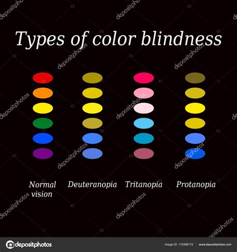 Types Of Color Blindness Eye Color Perception Vector Illustration On
